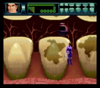 Rex Ronan - Experimental Surgeon (USA) snes download